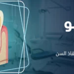 فشل حشو العصب: العلامات والأسباب ومتى يمكن إنقاذ السن؟