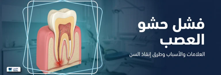 فشل حشو العصب: العلامات والأسباب ومتى يمكن إنقاذ السن؟