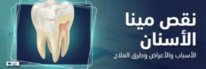 ما أعراض نقص مينا الأسنان؟