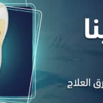 نقص مينا الأسنان: الأسباب والأعراض وطرق العلاج عند الأطفال والبالغين