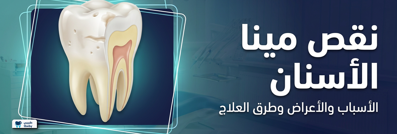 نقص مينا الأسنان: الأسباب والأعراض وطرق العلاج عند الأطفال والبالغين